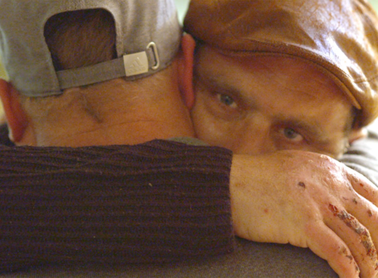 Two men in hats hugging, the visible hand is scabbed over in places